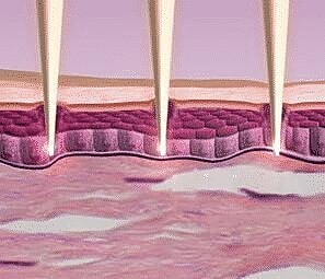 It’s all about Collagen!