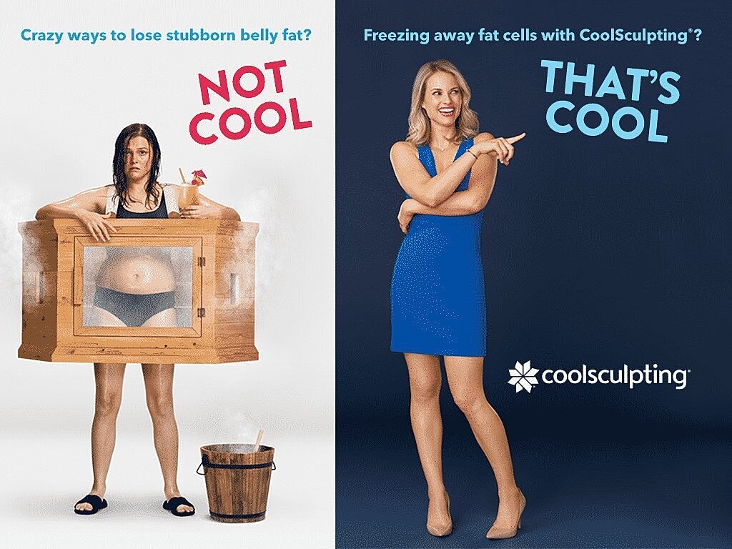 My CoolSculpting Experience