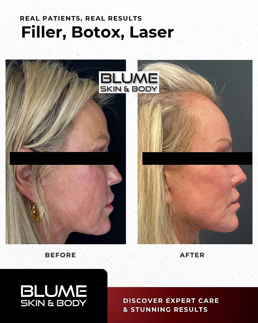 Before and after cosmetic treatment results.