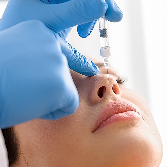 Injecting filler near the nose of a patient