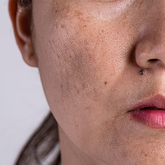 Close-up of woman’s face with natural features.