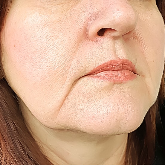Close-up of a woman's face highlighting features.