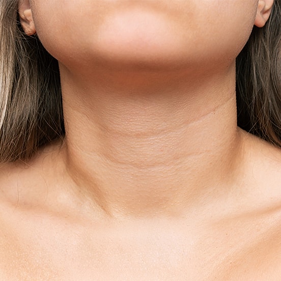 Close-up of neck and collarbone area.